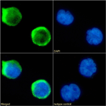 Anti-CD1a [CBT6]