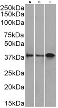 Anti-CD37 [IPO-24 (ZC37-24)]