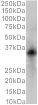 Anti-CD79b [HM79-16]