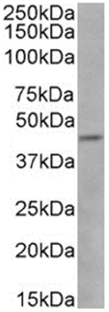 Anti-CCR5 (phosphoserine 337) [V14/2]