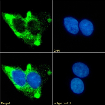Anti-Beta 2 adrenergic receptor [13D6]