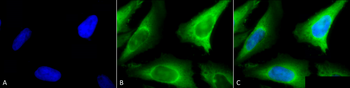 HSP40 Antibody