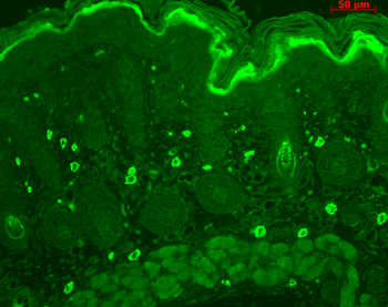 TNF-R1 Antibody