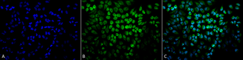 TNF-R1 Antibody