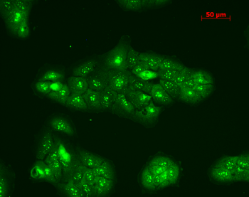 TNF-R1 Antibody