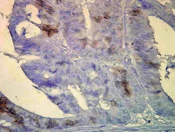 HSP70/HSC70 Antibody: Biotin