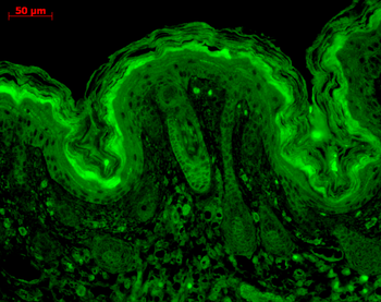 CaMKII (Alpha-Specific) Antibody: Biotin
