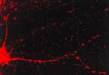 CaMKII (Alpha-Specific) Antibody: Biotin
