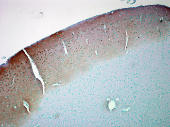 CaMKII (Alpha-Specific) Antibody: Biotin