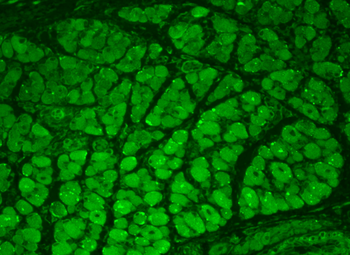 CaMKII Antibody: Biotin