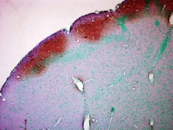 CaMKII Antibody: Biotin