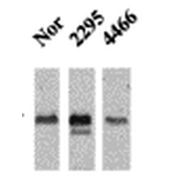 CaMKII Antibody: Biotin
