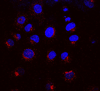 KDEL Receptor Antibody (RPE)