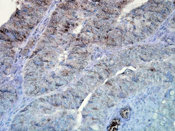 HSP90 Antibody (Biotin)