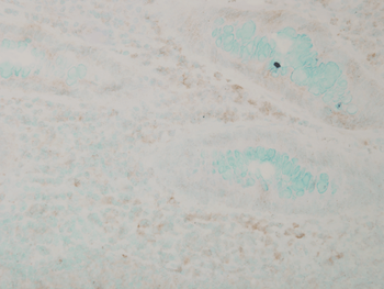 p38 alpha (MAP Kinase) Antibody: Biotin