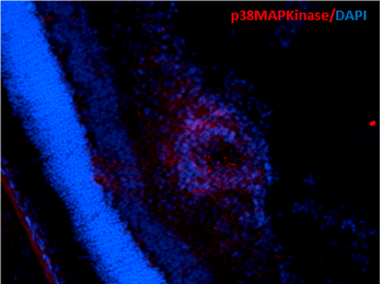 p38 alpha (MAP Kinase) Antibody: FITC
