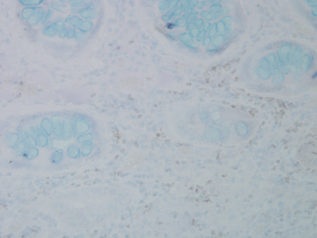 Nitrotyrosine Antibody: Biotin