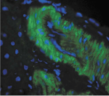 Nitrotyrosine Antibody: FITC