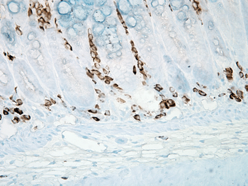 Nitrotyrosine Antibody: HRP