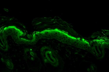 Nitrotyrosine Antibody: HRP