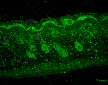 ERp57 (GRP58) Antibody: RPE
