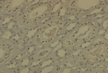 DNMT1 Antibody: APC