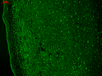 Cav3.2 Antibody: APC