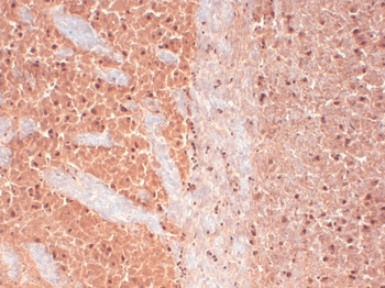 Cav3.2 Antibody: APC