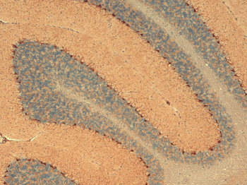 HCN1 Antibody: PerCP