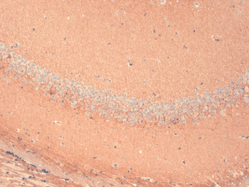 HCN1 Antibody: PerCP