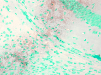 KCNQ1 Antibody: FITC