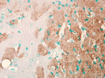 Nav1.7 Antibody: Biotin