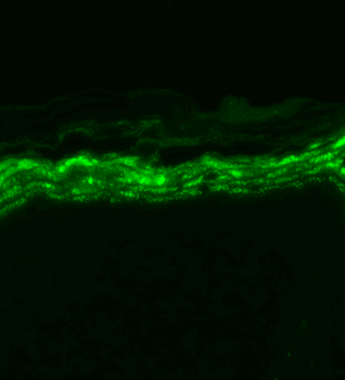 Nav1.7 Antibody: Biotin