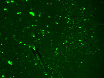 Nav1.7 Antibody: Biotin