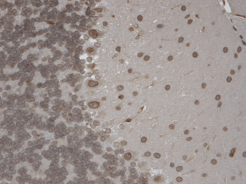 TrpM7 Antibody: PerCP