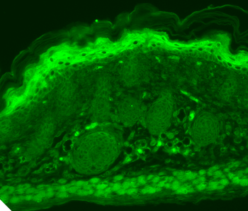 TrpV3 Antibody: RPE