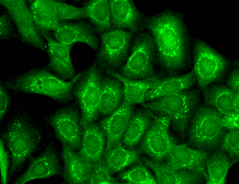 Slo2.2 Antibody: RPE