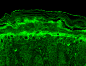 Slo2.2 Antibody: RPE