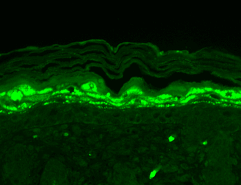 SHANK1 Antibody: PerCP