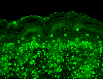 Cav beta 2 Antibody: APC