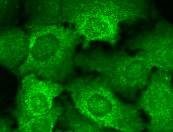 Cav beta 2 Antibody: Biotin