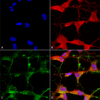 TRPV3 Antibody (PerCP)