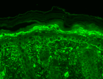 TrpV3 Antibody: RPE