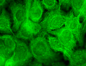 TrpV3 Antibody: RPE