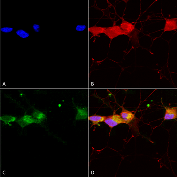 NR2B Antibody (FITC)