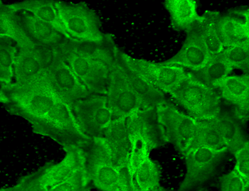 GluN2B/NR2B Antibody: PerCP