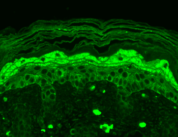 GluN2B/NR2B Antibody: PerCP