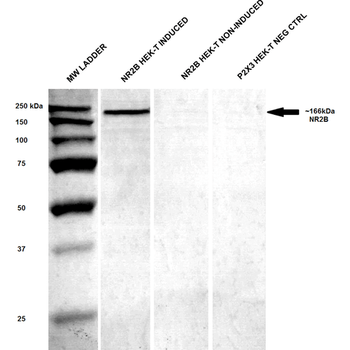 NR2B Antibody (RPE)