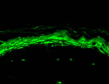 Nav1.8 Antibody (RPE)