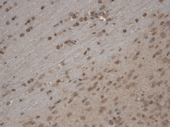 TrpC5 Antibody: APC